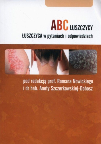 ABC łuszczycy. Łuszczyca w pytaniach i odpowiedziach