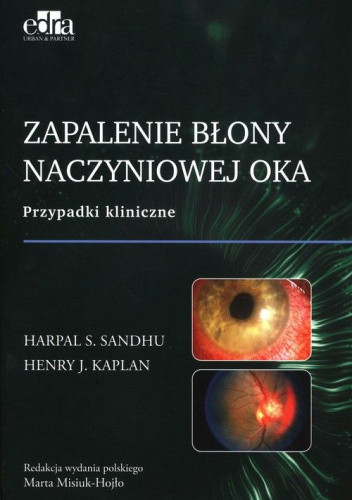 Zapalenie błony naczyniowej oka