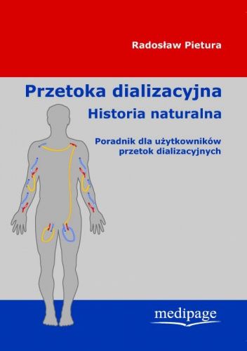 Przetoka dializacyjna - historia naturalna. Poradnik dla użytkowników przetok dializacyjnych