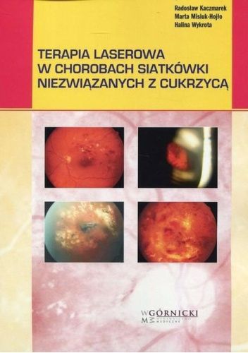 Terapia laserowa w chorobach siatkówki niezwiązanych z cukrzycą
