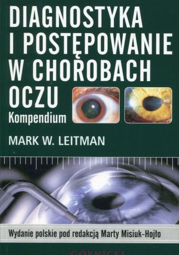 Diagnostyka i postępowanie w chorobach oczu. Kompendium