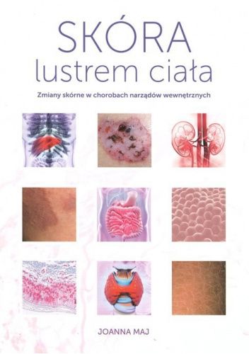 Skóra lustrem ciała. Zwiany skórne w chorobach narządów wewnętrznych