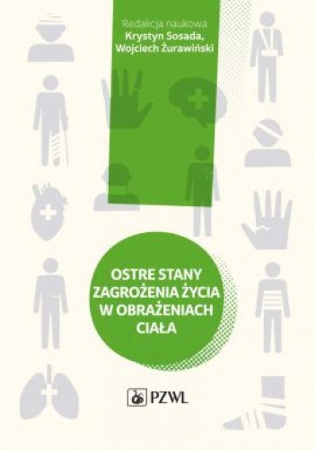 Ostre stany zagrożenia życia w obrażeniach ciała