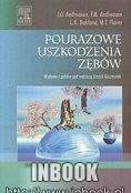 Pourazowe uszkodzenia zębów - red. Urszula Kaczmarek
