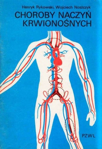Choroby naczyń krwionośnych