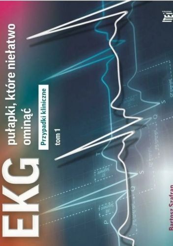 EKG. Pułapki, które niełatwo ominąć. Przypadki kliniczne. Tom 1