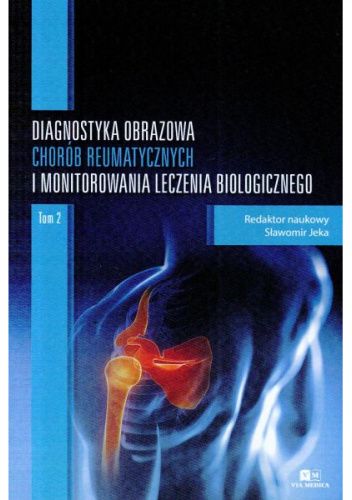 Diagnostyka obrazowa chorób reumatycznych i monitorowania leczenia biologicznego. Tom 2