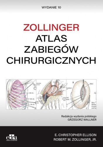 Atlas zabiegów chirurgicznych