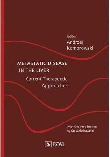 Metastatic Disease in the Liver - Current Therapeutic Approaches