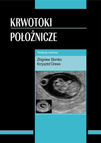 Krwotoki położnicze