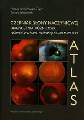 Czerniak błony naczyniowej. Diagnostyka różnicowa nowotworów wewnątrzgałkowych