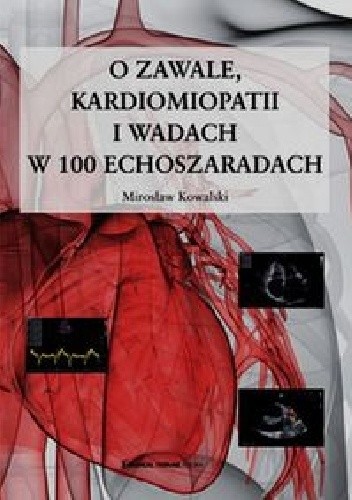 O zawale, kardiomiopatii i wadach w 100 echoszaradach