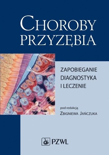Choroby przyzębia. Zapobieganie, diagnostyka i leczenie
