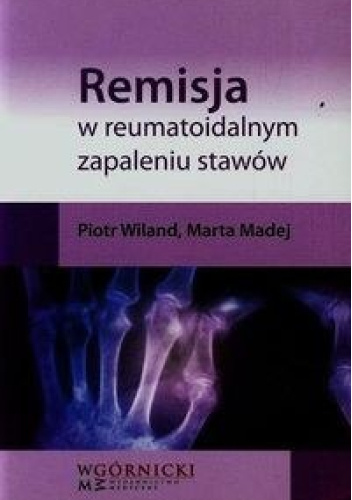 Remisja w reumatoidalnym zapaleniu stawów