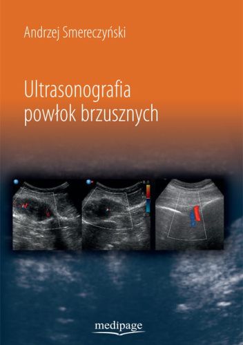 Ultrasonografia powłok brzusznych