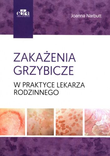 Zakażenia grzybicze w praktyce lekarza rodzinnego