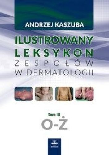 lustrowany leksykon zespołów w dermatologii. Tom III. O-Ż