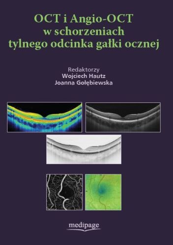 OCT i Angio-OCT w schorzeniach tylnego odcinka gałki ocznej