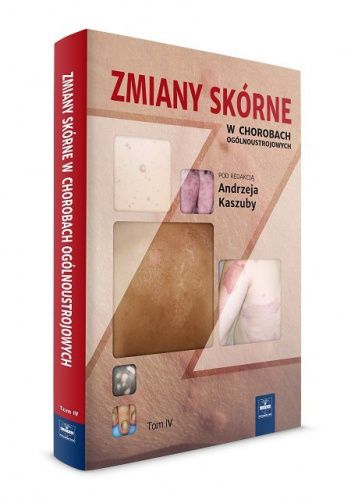 Zmiany skórne w chorobach ogólnoustrojowych. Tom 4