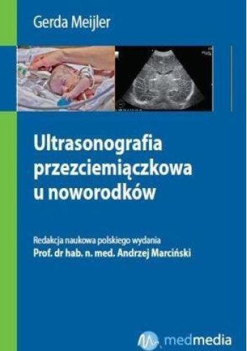 Ultrasonografia przezciemiączkowa u noworodków