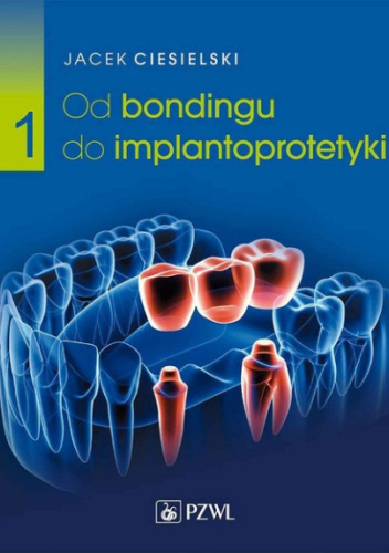 Od bondingu do implantoprotetyki. Część 1