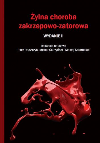 Żylna choroba zakrzepowo-zatorowa