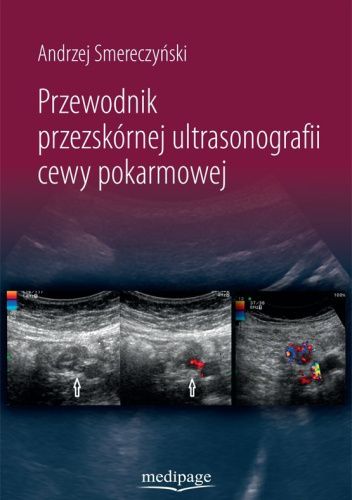 Przewodnik przezskórnej ultrasonografii cewy pokarmowej