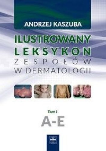Ilustrowany leksykon zespołów w dermatologii. Tom I. A-E