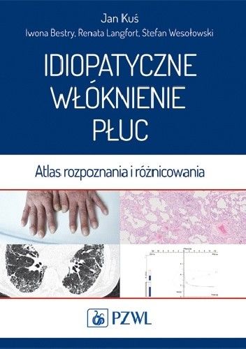 Idiopatyczne włóknienie płuc. Atlas rozpoznania i różnicowania