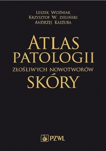 Atlas patologii złośliwych nowotworów skóry