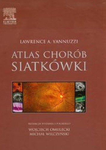 Atlas chorób siatkówki