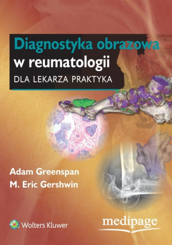 Diagnostyka obrazowa w reumatologii dla lekarza praktyka