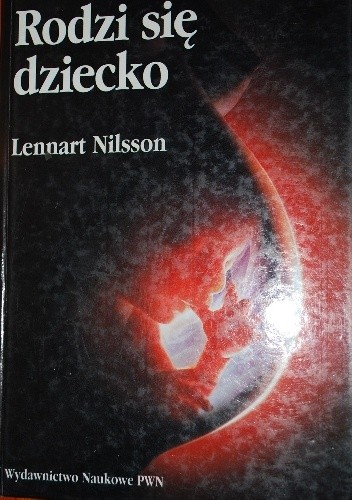 Rodzi się dziecko