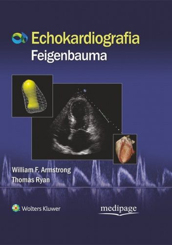 Echokardiografia Feigenbauma