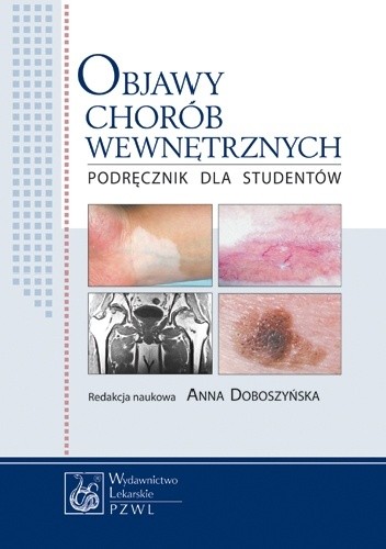 Objawy chorób wewnętrznych