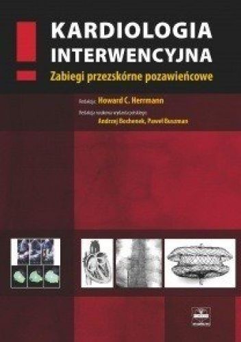 Kardiologia interwencyjna. Zabiegi przezskórne pozawieńcowe