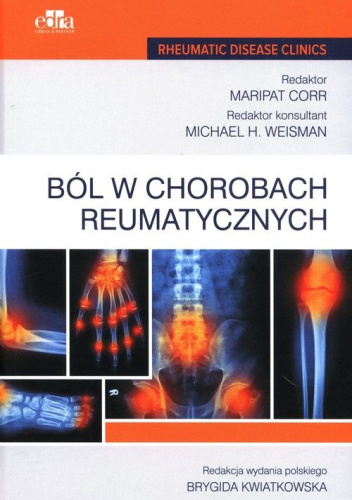Ból w chorobach reumatycznych