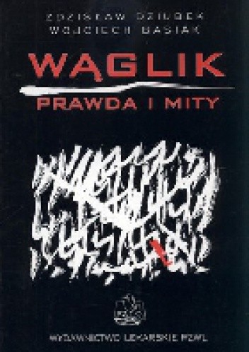 Wąglik. Prawda i mity