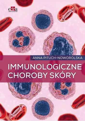 Immunologiczne choroby skóry