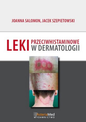 Leki przeciwhistaminowe w dermatologii