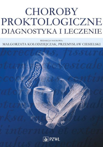 Choroby proktologiczne. Diagnostyka i leczenie