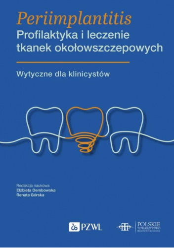 Periimplantitis. Profilaktyka i leczenie tkanek okołowszczepowych. Wytyczne dla klinicystów