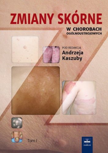Zmiany skórne w chorobach ogólnoustrojowych. Tom 1