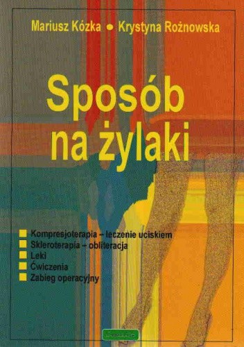 Sposób na żylaki