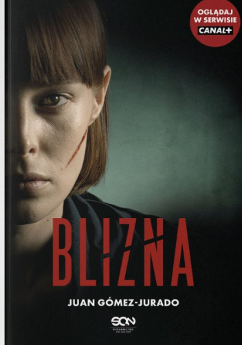 Blizna