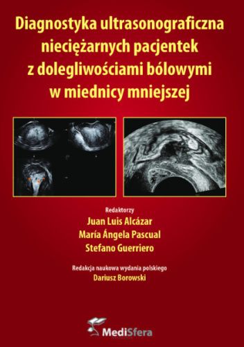 Diagnostyka ultrasonograficzna nieciężarnych pacjentek z dolegliwościami bólowymi w miednicy mniejszej