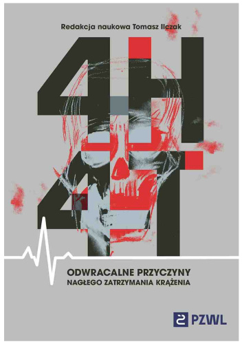 4H i 4T. Odwracalne przyczyny nagłego zatrzymania krążenia