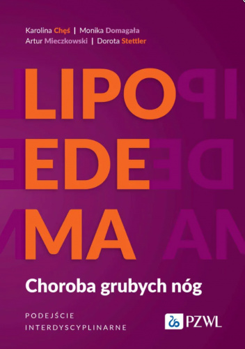 Lipoedema. Choroba grubych nóg. Podejście interdyscyplinarne