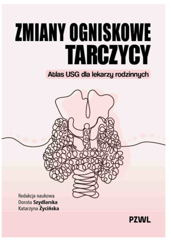 Zmiany ogniskowe tarczycy. Atlas USG dla lekarzy rodzinnych