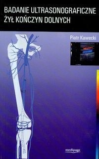 Badanie ultrasonograficzne żył kończyn dolnych
